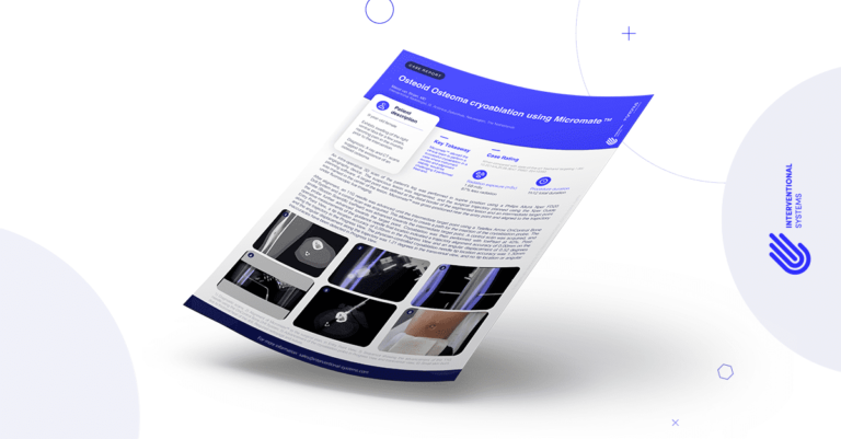 Case Report of a robotic-guided osteoid osteoma cryoablation